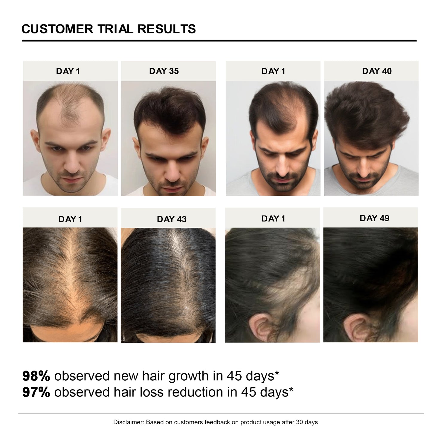 Advance Hair Growth Serum(Pack Of 2)