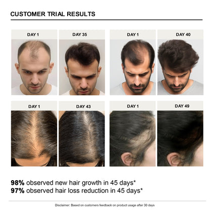 Advance Hair Growth Serum(Pack Of 2)