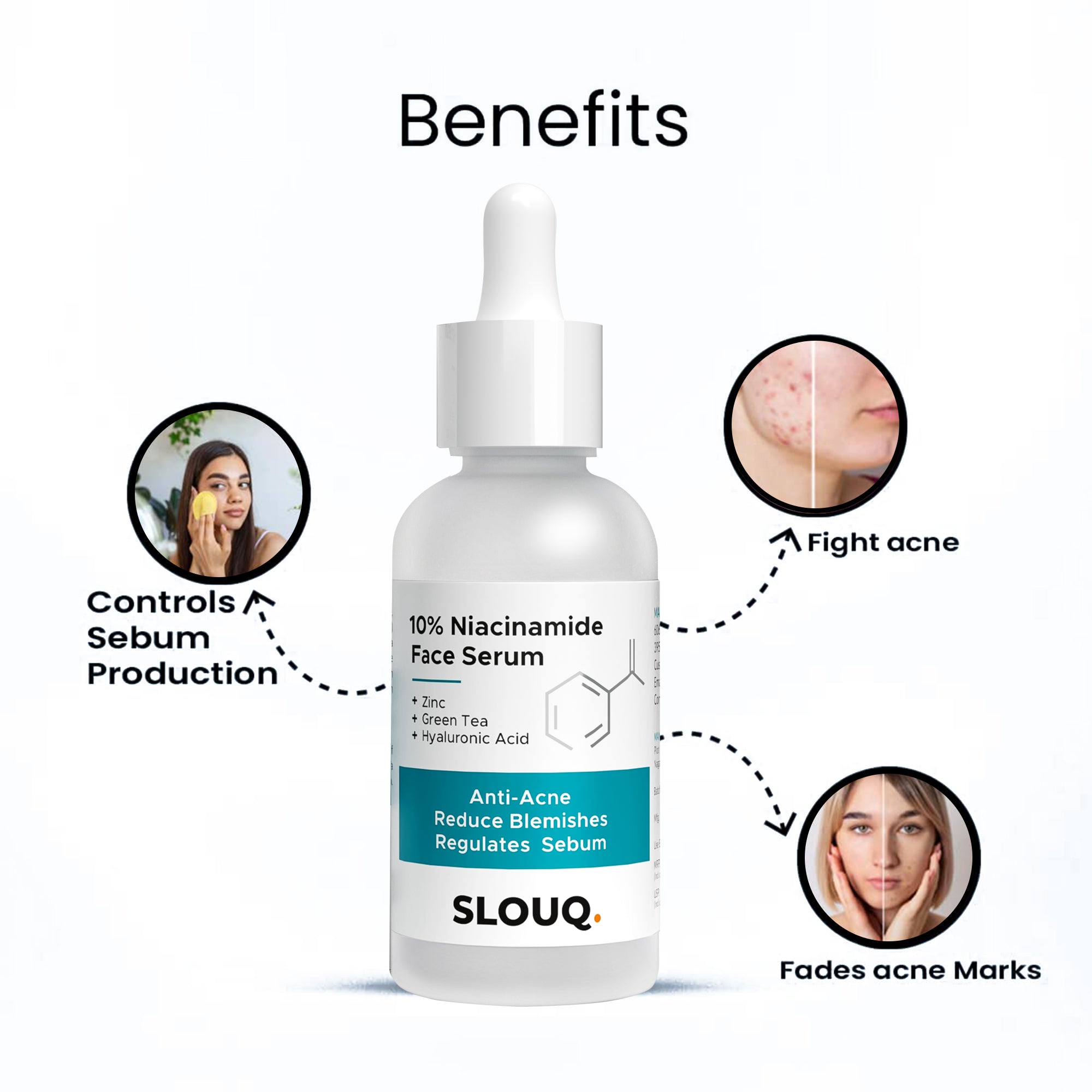 Slouq 10% Niacinamide Face Serum with Zinc - Reduces Acne Marks &amp; Dark Spots - Skin Clarifying Anti Acne Serum for Oily &amp; Acne Prone Skin - 30ml