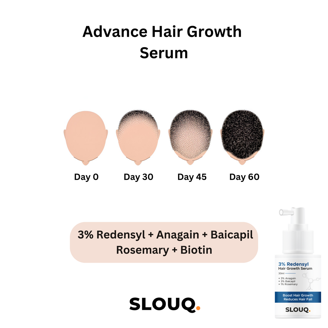 Slouq Hair Growth Serum Concentrate - 3% Redensyl, 3% Anagain, 3% Baicapil, 1% Rosemary, Biotin, Plant Keratin - Hair Growth Serum for Men &amp; Women - 30ml